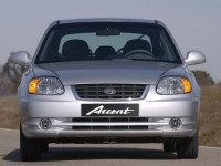 Hyundai Accent Hatchback 5-door. (LC) 1.5 MT (102hp) opiniones, Hyundai Accent Hatchback 5-door. (LC) 1.5 MT (102hp) precio, Hyundai Accent Hatchback 5-door. (LC) 1.5 MT (102hp) comprar, Hyundai Accent Hatchback 5-door. (LC) 1.5 MT (102hp) caracteristicas, Hyundai Accent Hatchback 5-door. (LC) 1.5 MT (102hp) especificaciones, Hyundai Accent Hatchback 5-door. (LC) 1.5 MT (102hp) Ficha tecnica, Hyundai Accent Hatchback 5-door. (LC) 1.5 MT (102hp) Automovil